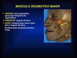 MÚSCULO ZIGOMÁTICO MAIOR
 ORIGEM: osso zigomático
(processo temporal do
zigomático)
 INSERÇÃO: ângulo da boca
 AÇÃO: levantar para cima e para
fora o ângulo da boca.
Conformação arqueada da boca.
(riso)
 