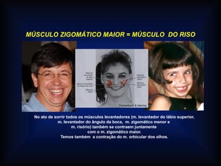 MÚSCULO ZIGOMÁTICO MAIOR = MÚSCULO DO RISO
No ato de sorrir todos os músculos levantadores (m. levantador do lábio superior,
m. levantador do ângulo da boca, m. zigomático menor e
m. risório) também se contraem juntamente
com o m. zigomático maior.
Temos também a contração do m. orbicular dos olhos.
Fehrenbach & Herring
 