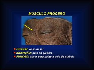 MÚSCULO PRÓCERO
 ORIGEM: osso nasal
 INSERÇÃO: pele da glabela
 FUNÇÃO: puxar para baixo a pele da glabela
 