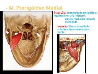 - M. Pterigóideo Medial
Inserção: Tuberosidade pterigóidea:
localizada nos 2/3 inferiores
da face medial do ramo da
mandíbula
Inserção: Eleva a mandíbula
e desloca ligeiramente para
frente.
 