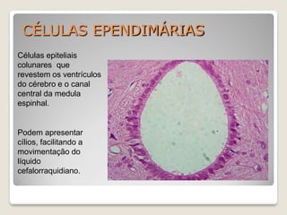 CÉLULAS EPENDIMÁRIAS
Células epiteliais
colunares que
revestem os ventrículos
do cérebro e o canal
central da medula
espinhal.
Podem apresentar
cílios, facilitando a
movimentação do
líquido
cefalorraquidiano.
 