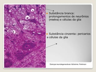 ⚫ Substância branca:
prolongamentos de neurônios
(mielina) e células da glia
⚫ Substância cinzenta: pericarios
e células da glia
Doenças neurodegenerativas: Alzheimer, Parkinson
 