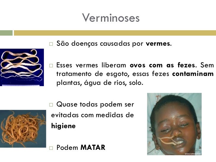 Quantos gramas de carboidratos é necessário para a menina perder o peso