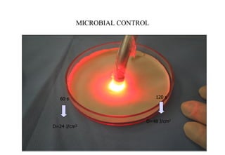 MICROBIAL CONTROL

60 s

D=24 J/cm2

120 s

D=48 J/cm2

 