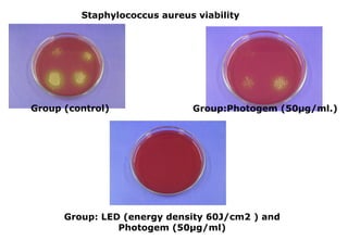 Staphylococcus aureus viability

Group (control)

Group:Photogem (50µg/ml.)

Group: LED (energy density 60J/cm2 ) and
Photogem (50µg/ml)

 