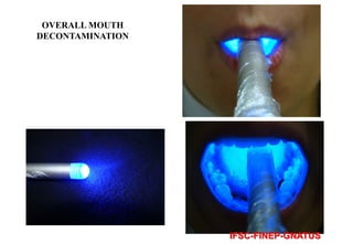 OVERALL MOUTH
DECONTAMINATION

IFSC-FINEP-GNATUS

 