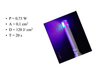• 
• 
• 
• 

P = 0,73 W
A = 0,1 cm2
D = 120 J/ cm2
T = 20 s

 