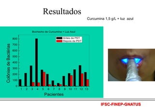 Resultados
Curcumina 1,5 g/L + luz azul

Bochecho de Curcumina + Luz Azul
Antes da PDT
Depois da PDT

Colônias de Bactérias

800
700
600
500
400
300
200
100
0
1

2

3

4

5

6

7

8

9

10 11 12 13

Pacientes
IFSC-FINEP-GNATUS

 