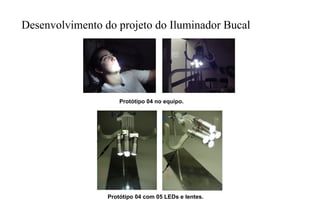 Desenvolvimento do projeto do Iluminador Bucal

Protótipo 04 no equipo.

Protótipo 04 com 05 LEDs e lentes.

 