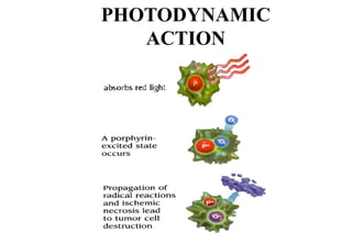 PHOTODYNAMIC
ACTION

 