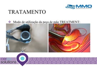TRATAMENTO
v  Modo de utilização da peça de mão TREATMENT:

 