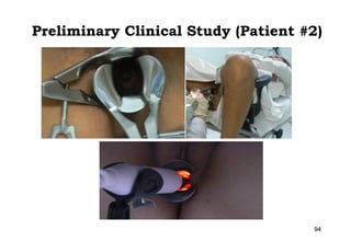 Preliminary Clinical Study (Patient #2)

94

 