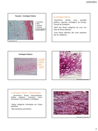 12/07/2015
2
Traquéia – Cartilagem Hialina
Cartilagem hialina X 10
1
2
3
4
5
1 – Condroblasto
2 – Matriz
3 – Condrócito
4 – Pericôndrio
5 – Células adiposas do
conjuntivo adjacente
b) Cartilagem Elástica
.Ocorrência: Orelha, nariz, pavilhão
auditivo, algumas cartilagens da laringe,
Trompa de Eustáquio.
.Além das fibras colágenas há uma rica
rede de fibras elásticas.
.Suas fibras elásticas são mais espessas
que as colágenas.
Cartilagem Elástica
Cartilagem elástica X 10
1
2
3
4
5
1 – Condroblasto
2 – Condrócito
3 – Pericôndrio
4 – Matriz
5 – Conjuntivo
adjacente
Fonte:Junqueira e Carneiro, 2004
c) Cartilagem Fibrosa = Fibrocartilagem
. Ocorrência: Discos intervertebrais,
sínfise pubiana, meniscos intra-
articulares, fixa tendões à cartilagem
.Fibras colágenas orientadas em feixes
paralelos.
.Não apresenta pericôndrio
Fonte:Junqueira e Carneiro, 2004
 