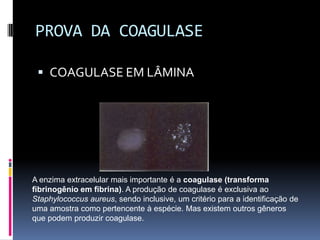 PROVA DA COAGULASECOAGULASE EM LÂMINAA enzima extracelular mais importante é a coagulase (transforma fibrinogênio em fibrina). A produção de coagulase é exclusiva ao Staphylococcus aureus, sendo inclusive, um critério para a identificação de uma amostra como pertencente à espécie. Mas existem outros gêneros que podem produzir coagulase.