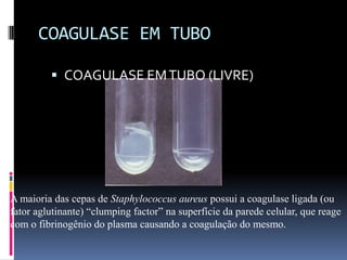 COAGULASE EM TUBOCOAGULASE EM TUBO (LIVRE)A maioria das cepas de Staphylococcus aureus possui a coagulase ligada (ou fator aglutinante) “clumping factor” na superfície da parede celular, que reage com o fibrinogênio do plasma causando a coagulação do mesmo.
