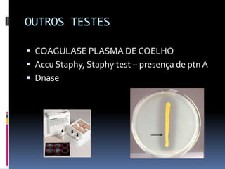 OUTROS TESTESCOAGULASE PLASMA DE COELHOAccu Staphy, Staphy test – presença de ptn ADnase