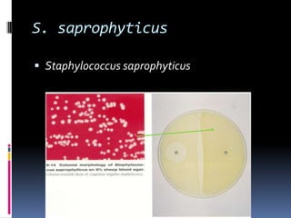 S. saprophyticusStaphylococcus saprophyticus