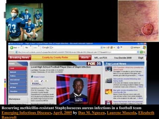 Recurring methicillin-resistant Staphylococcus aureus infections in a football teamEmerging Infectious Diseases, April, 2005 by Dao M. Nguyen, Laurene Mascola, Elizabeth Bancroft