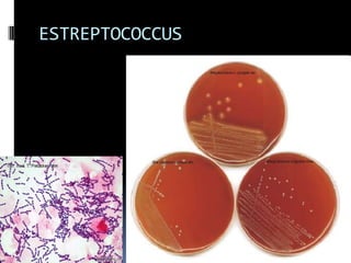 ESTREPTOCOCCUS 