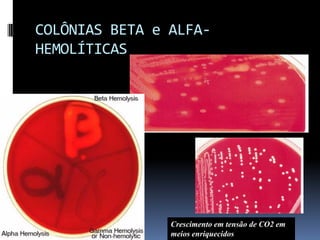 COLÔNIAS BETA e ALFA-HEMOLÍTICASCrescimento em tensão de CO2 em meios enriquecidos