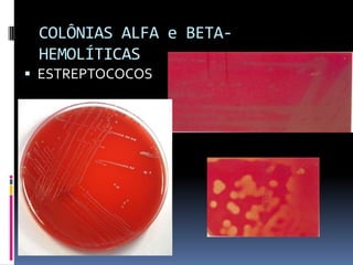COLÔNIAS ALFA e BETA-HEMOLÍTICASESTREPTOCOCOS