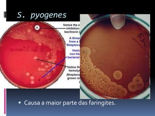 S. pyogenesCausa a maior parte das faringites.
