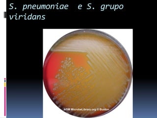 S. pneumoniae  e S. grupo viridans
