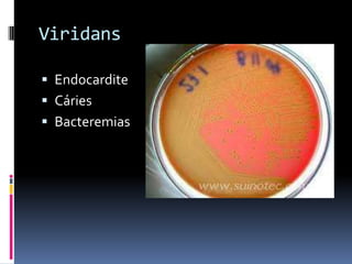 ViridansEndocarditeCáriesBacteremias