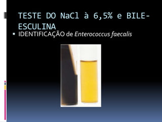 TESTE DO NaCl à 6,5% e BILE-ESCULINAIDENTIFICAÇÃO de Enterococcus faecalis