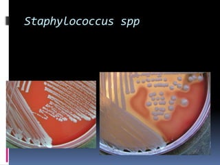 Staphylococcus spp