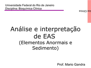 icaClínica
Análise e interpretação
de EAS
(Elementos Anormais e
Sedimento)
Universidade Federal do Rio de Janeiro
Disciplina: Bioquímica Clínica
Prof. Mario Gandra
 