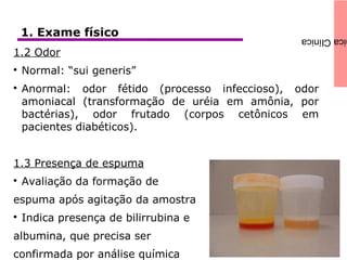icaClínica1. Exame físico
1.2 Odor

Normal: “sui generis”

Anormal: odor fétido (processo infeccioso), odor
amoniacal (transformação de uréia em amônia, por
bactérias), odor frutado (corpos cetônicos em
pacientes diabéticos).
1.3 Presença de espuma

Avaliação da formação de
espuma após agitação da amostra

Indica presença de bilirrubina e
albumina, que precisa ser
confirmada por análise química
 
