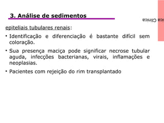 icaClínica3. Análise de sedimentos
epiteliais tubulares renais:

Identificação e diferenciação é bastante difícil sem
coloração.

Sua presença maciça pode significar necrose tubular
aguda, infecções bacterianas, virais, inflamações e
neoplasias.

Pacientes com rejeição do rim transplantado
 