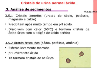 icaClínica3. Análise de sedimentos
3.5.1 Cristais amorfos (uratos de sódio, potássio,
magnésio e cálcio)

Precipitam após muito tempo em pH ácido

Dissolvem com calor (60o
C) e formam cristais de
ácido úrico com a adição de ácido acético
3.5.2 Uratos cristalinos (sódio, potássio, amônio)

Esferas levemente marrons

pH levemente ácido

Tb formam cristais de ác úrico
Cristais de urina normal ácida
 