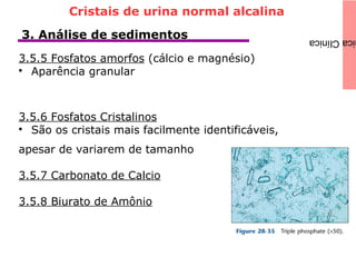 icaClínica3. Análise de sedimentos
3.5.5 Fosfatos amorfos (cálcio e magnésio)

Aparência granular
3.5.6 Fosfatos Cristalinos

São os cristais mais facilmente identificáveis,
apesar de variarem de tamanho
3.5.7 Carbonato de Calcio
3.5.8 Biurato de Amônio
Cristais de urina normal alcalina
 