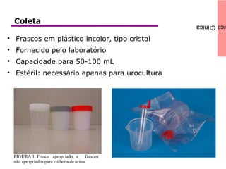 icaClínicaColeta

Frascos em plástico incolor, tipo cristal

Fornecido pelo laboratório

Capacidade para 50-100 mL

Estéril: necessário apenas para urocultura
 