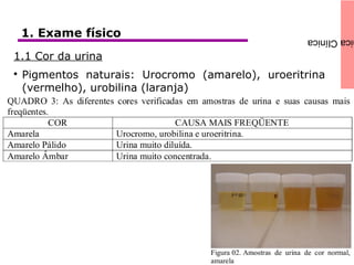 icaClínica1. Exame físico
1.1 Cor da urina

Pigmentos naturais: Urocromo (amarelo), uroeritrina
(vermelho), urobilina (laranja)
 