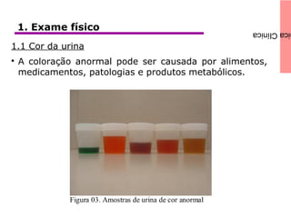 icaClínica1. Exame físico
1.1 Cor da urina

A coloração anormal pode ser causada por alimentos,
medicamentos, patologias e produtos metabólicos.
 