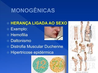  HERANÇA LIGADA AO SEXO
 Exemplo:
 Hemofilia
 Daltonismo
 Distrofia Muscular Duchenne
 Hipertricose epidérmica
 