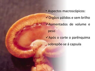 • Aspectos macroscópicos:
Órgãos pálidos e sem brilho
Aumentados de volume e
peso
Após o corte o parênquima
sobrepõe-se á capsula
 