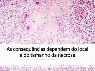 As consequências dependem do local
e do tamanho da necrose
 