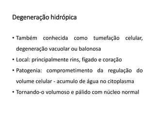 Degeneração hidrópica
• Também conhecida como tumefação celular,
degeneração vacuolar ou balonosa
• Local: principalmente rins, fígado e coração
• Patogenia: comprometimento da regulação do
volume celular - acumulo de água no citoplasma
• Tornando-o volumoso e pálido com núcleo normal
 