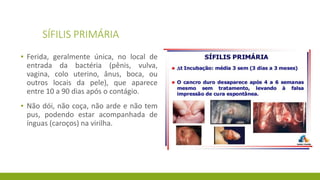 aula-5-sif-lis-1-pptx