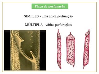 SIMPLES - uma única perfuração
MÚLTIPLA - várias perfurações
Placa de perfuração
 