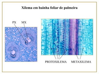 Xilema em bainha foliar de palmeira
PROTOXILEMA METAXILEMA
PX MX
 
