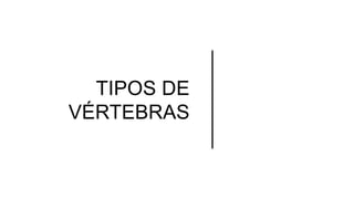 TIPOS DE
VÉRTEBRAS
 