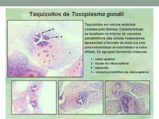 Morfologia - Taquizoíto
 