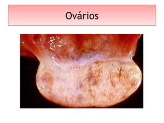 OváriosOvários
 