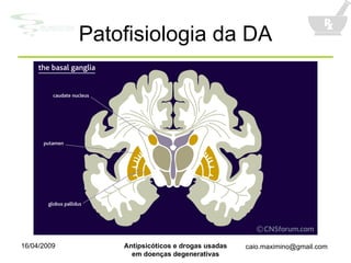 Patofisiologia da DA 