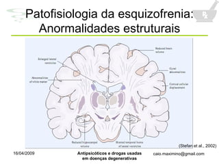 Patofisiologia da esquizofrenia: Anormalidades estruturais (Stefan et al., 2002) 